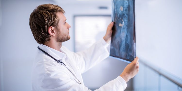 Male doctor examining x-ray in corridor