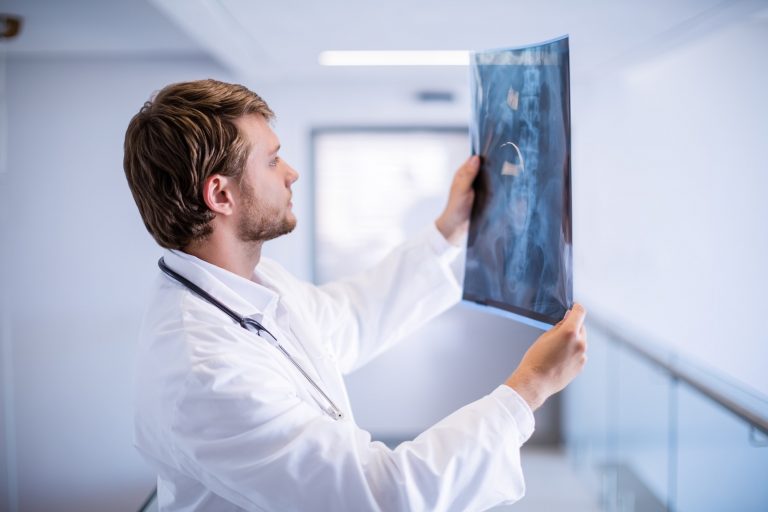 Male doctor examining x-ray in corridor